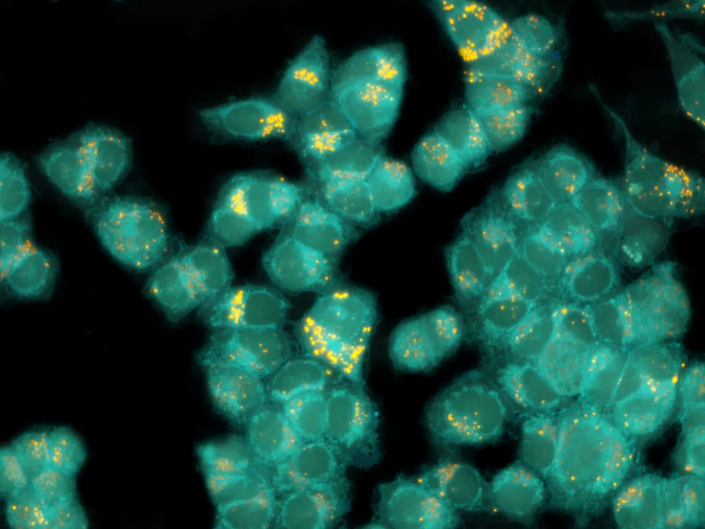 Images of cancer cells; credit: Dr. Katarzyna Malarz