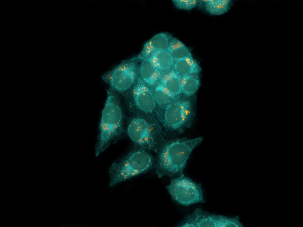 Images of cancer cells; credit: Dr. Katarzyna Malarz