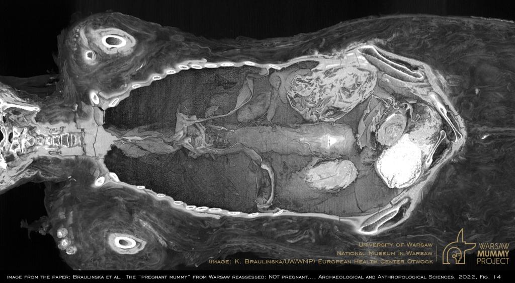 3D monochrome cross-sectional reconstruction of the mummy using OsiriX MD (Pixmeo) software. A view from the front to the insides of the mummy filled with packages of various nature, some containing internal organs removed earlier and mummified separately. K. Braulińska (UW/WMP)