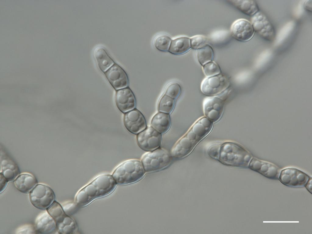 Formicomyces microglobosus ined. Bar = 50 um 3. Credit: M.Piątek & I. Siedlecki