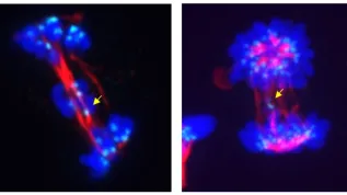 Abnormal cell division due to inhibition (left panel) or degradation (right panel) of CDK5. Yellow arrows indicate chromosomes that did not move to daughter cells. Credit: Bartłomiej Tomasik, Medical University of Gdańsk