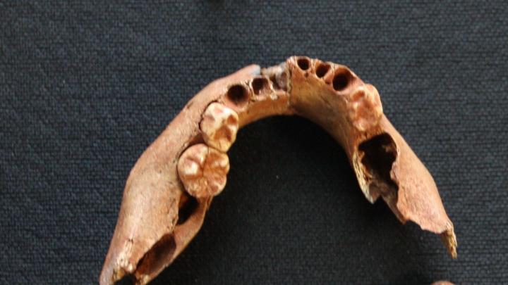 Jaw and teeth of a 3-year-old child discovered in Pierkunowo-Giżycko. Dental material of a child (3-year-old) from Pierkunowo-Giżycko, credit: J. Tomczyk
