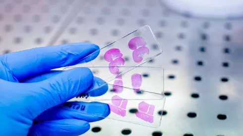 Histologizne preparaty nerki, wątroby i śledziony szczura, Adobe Stock