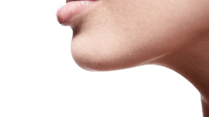 Photo: Fotolia