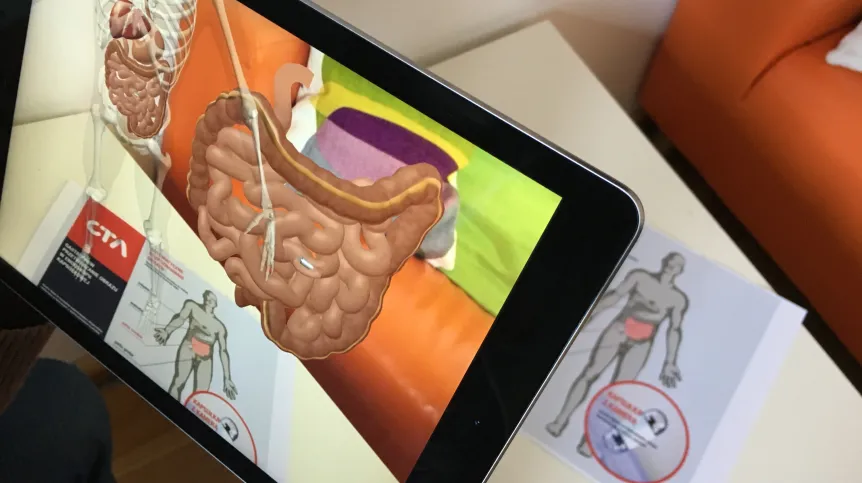 Test simulation in Augmented Reality - the capsule travelling inside the intestine. Source: CTAdventure