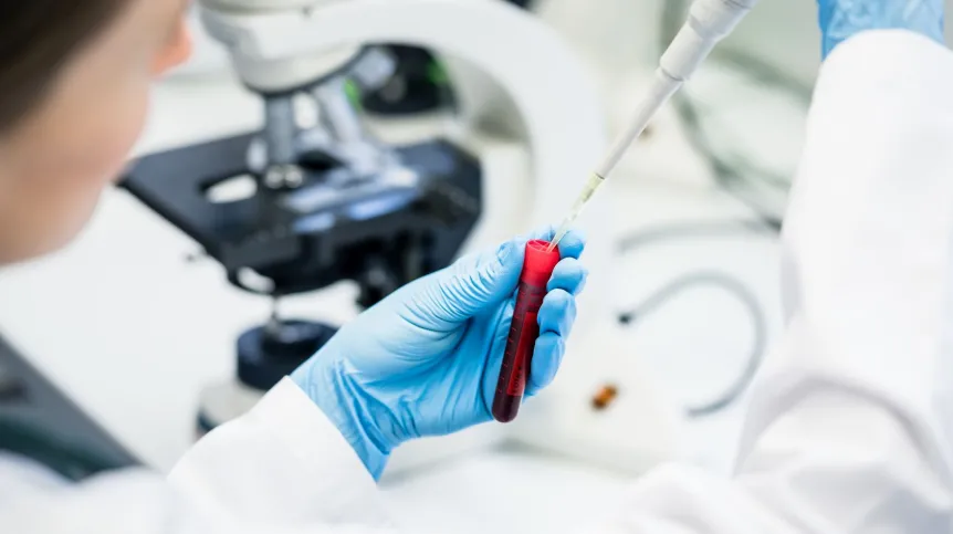 Doctor or lab assistant putting solution in blood test at the laboratory