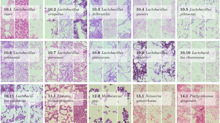 Perhaps someday an image from an optical microscope will suffice for artificial intelligence to identify the species of bacteria. The image shows the bacteria analysed in the research of scientists from the Jagiellonian University and Cracow University of Technology. Each species is illustrated by three examples. Source: PLOS One, Bartosz Zieliński et al.