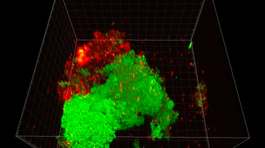 Fig. Anna Banach; confocal microscope image showing fluorescent nitrifying bacteria in activated sludge