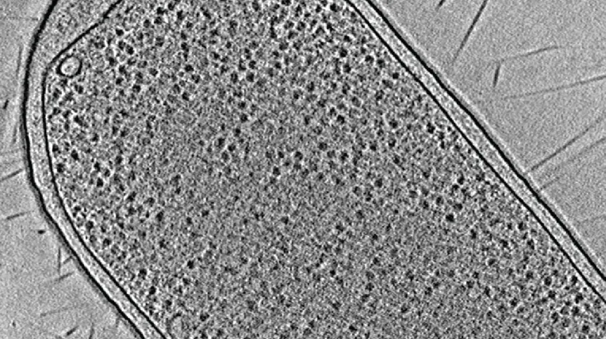 Pojedynczy 'plaster' kriotomogramu komórki E. coli. Źródło: Piotr Szwedziak