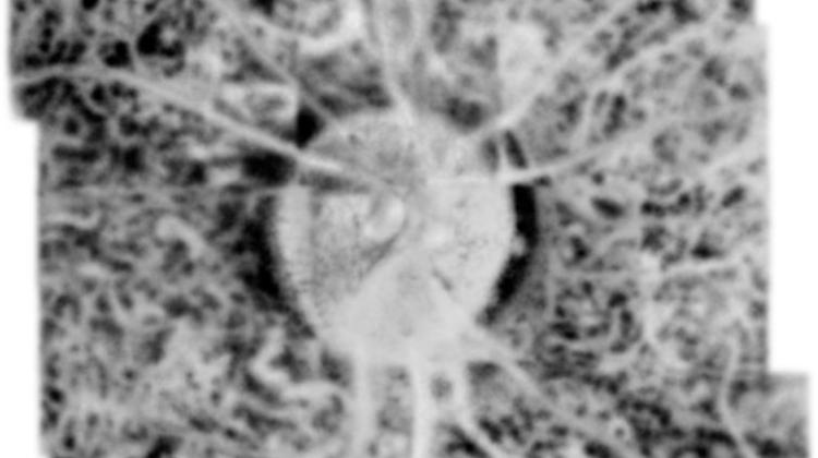 Image of a selected layer in the human choroid obtained with the new STOC-T method. Credit: Credit: Institute of Physical Chemistry PAS