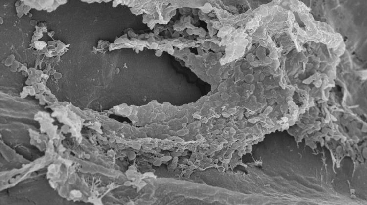 Zdjęcie spod mikroskopu skaningowego gąbki z biofilmem. Fot. Anna Dzionek