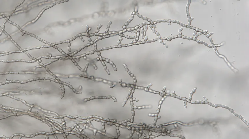 Formicomyces microglobosus ined. Bar = 50 um 1. Credit: M.Piątek & I. Siedlecki