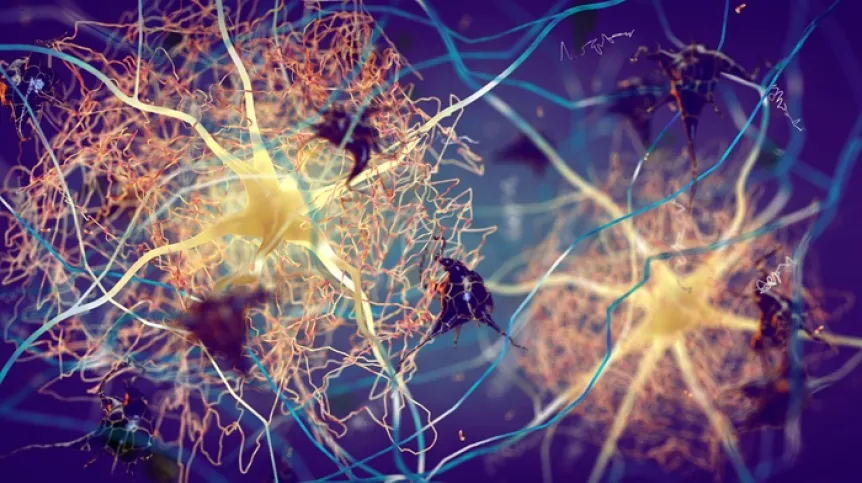 Białko Beta-amyloid i neurony w mózgu osoby chorej na Alzheimera.Adobe Stock
