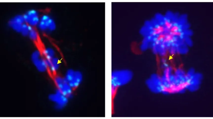 Abnormal cell division due to inhibition (left panel) or degradation (right panel) of CDK5. Yellow arrows indicate chromosomes that did not move to daughter cells. Credit: Bartłomiej Tomasik, Medical University of Gdańsk