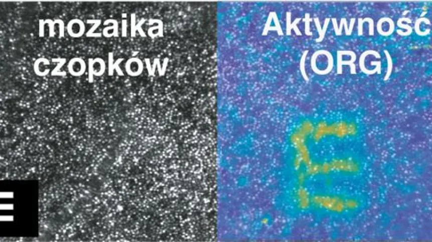 Obraz wyświetlany przed oczami jest widoczny w ruchu komórek światłoczułych na siatkówce. Źródło: M.Wojtkowski 