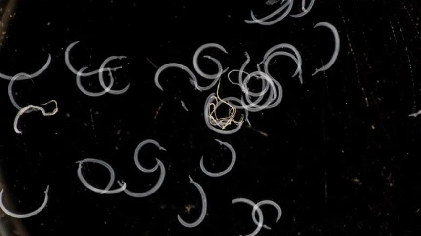 Schistosoma , Adobe Stock