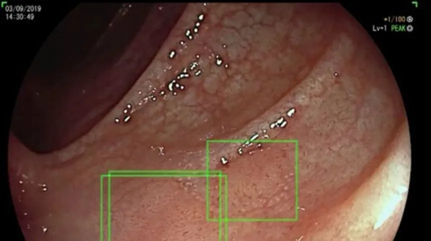 Photo from press release