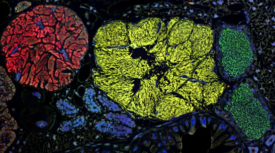 Symbiotic bacteria that inhabit the tissues of a planthopper. The fluorescence microscope image shows three types of symbionts, marked with different colours. These microorganisms supplement the insect's diet with essential amino acids not found in plant sap. Anna Michalik; mBio (2021), CC BY