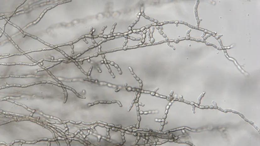 Formicomyces microglobosus ined. Bar = 50 um 1. Fot.  M.Piątek &amp;amp; I. Siedlecki