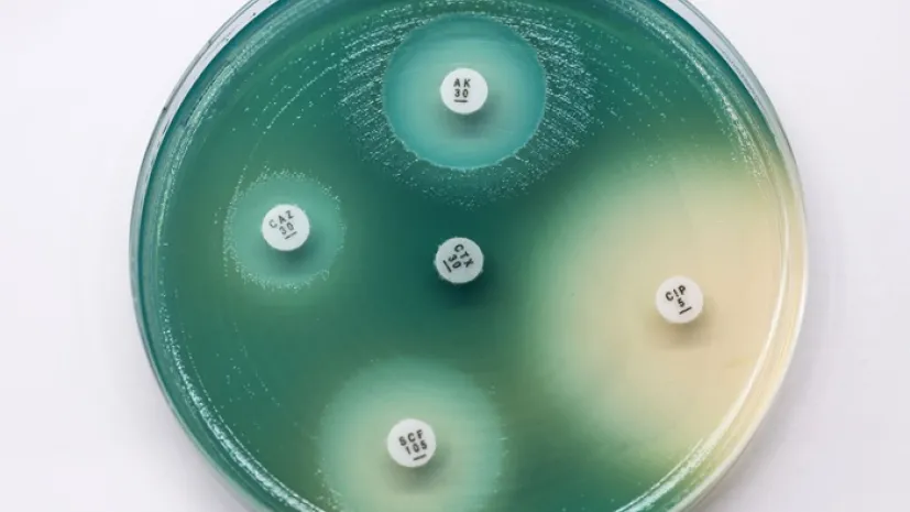 Pseudomonas aeruginosa, fot. Adobe Stock