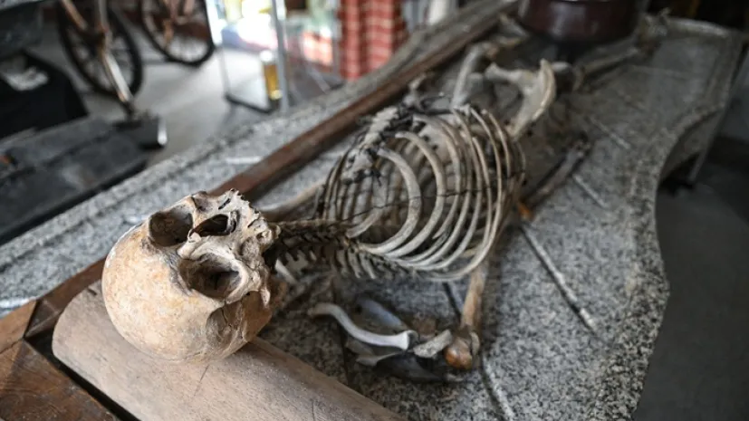 Eksponaty w Muzeum Medycyny Sądowej Uniwersytetu Medycznego we Wrocławiu (sko) PAP/Maciej Kulczyński